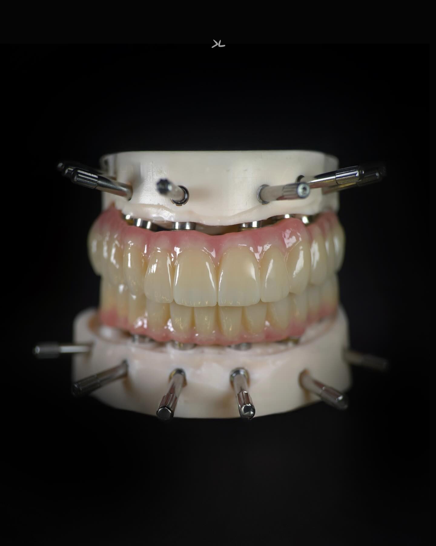 Rehabilitación completa sobre implantes montada en articulador