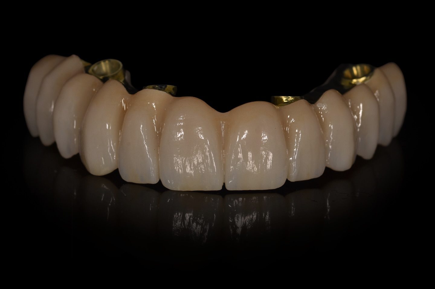 Rehabilitación completa sobre implantes fabricada por KL Dental Lab