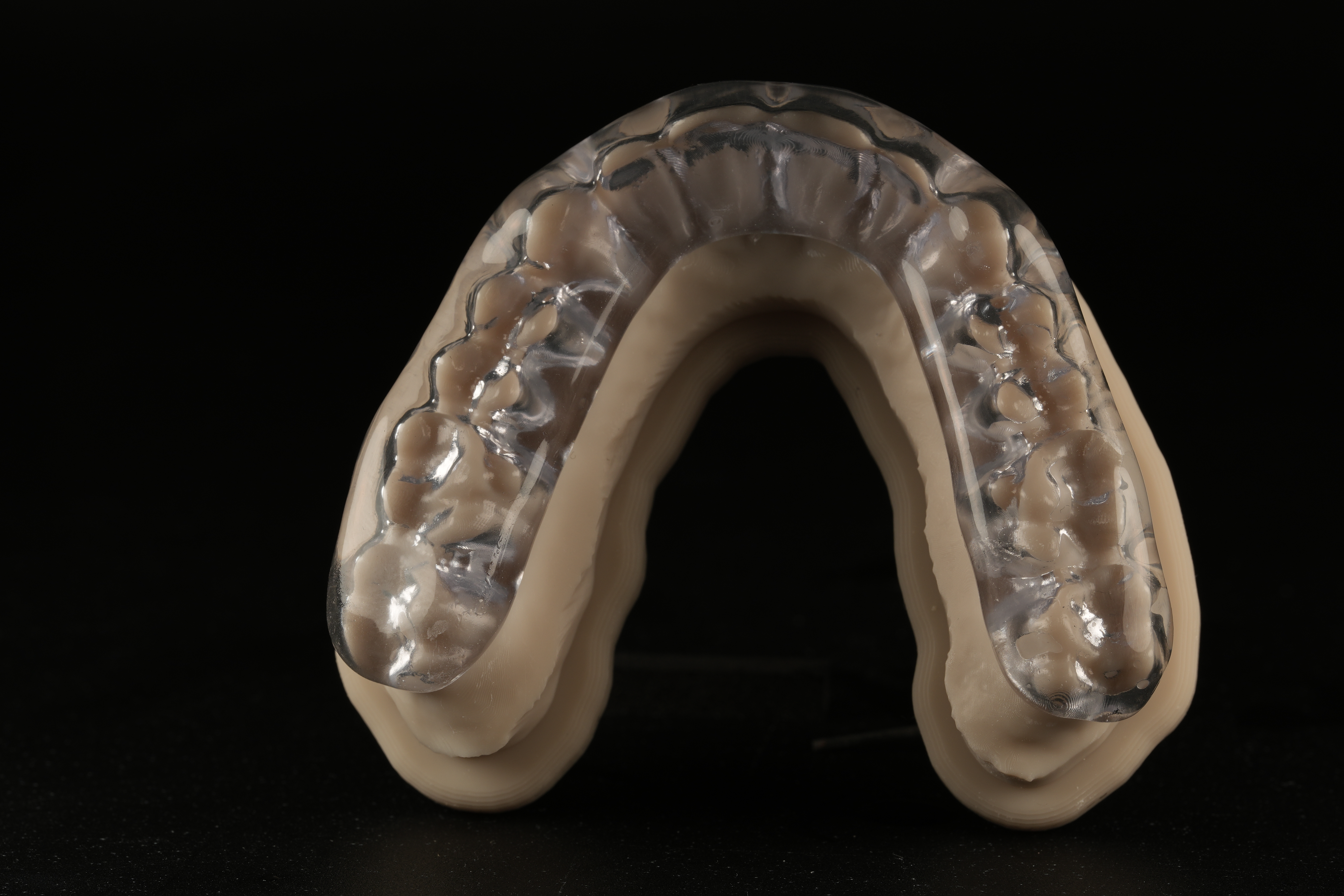 Férula transparente sobre un modelo dental, realizada en KL Dental Lab